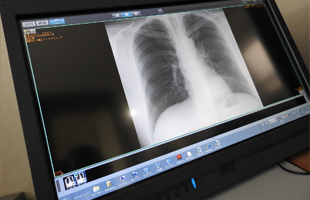 デジタルX線画像診断の写真